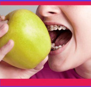 The Top 10 Foods To Eat With Braces | Orthodontist in Salt Lake City, UT